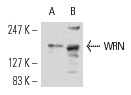 WRN (H-300): sc-5629. Western blot analysis of WRN expression in KNRK nuclear extract (A) and NAMALWA whole cell lysate (B).