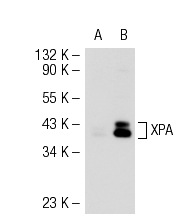 XPA (B-1): sc-28353. Western blot analysis of XPA expression in non-transfected: sc-117752 (A) and mouse XPA transfected: sc-126255 (B) 293T whole cell lysates.