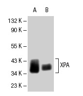 XPA (B-1): sc-28353. Western blot analysis of XPA expression in GM637 (A) and mouse Lac Z (B) whole cell lysates.