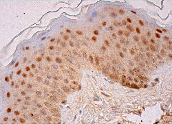 XPA (B-1): sc-28353. Immunoperoxidase staining of formalin fixed, paraffin-embedded human skin tissue showing nuclear staining of fibroblasts, keratinocytes, Langerhans cells and melanocytes.