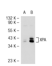 XPA (FL-273): sc-853. Western blot analysis of XPA expression in non-transfected: sc-117752 (A) and mouse XPA transfected: sc-126255 (B) 293T whole cell lysates.