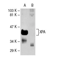XPA (FL-273): sc-853. Western blot analysis of whole cell lysates prepared from XPA expressing GM637 (A) and non-expressing XP12RO (B) cell lines. Cells kindly provided by J. Cleaver.