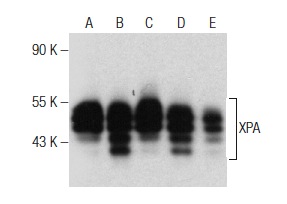 XPA (12F5): sc-56813. Western blot analysis of XPA expression in BJAB (A), MCF7 (B), TF-1 (C) and HeLa (D) nuclear extracts and GM637 whole cell lysate (E).