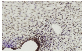 YAP (63.7): sc-101199. Immunoperoxidase staining of formalin-fixed, paraffin-embedded human endometrium tissue showing nuclear localization.