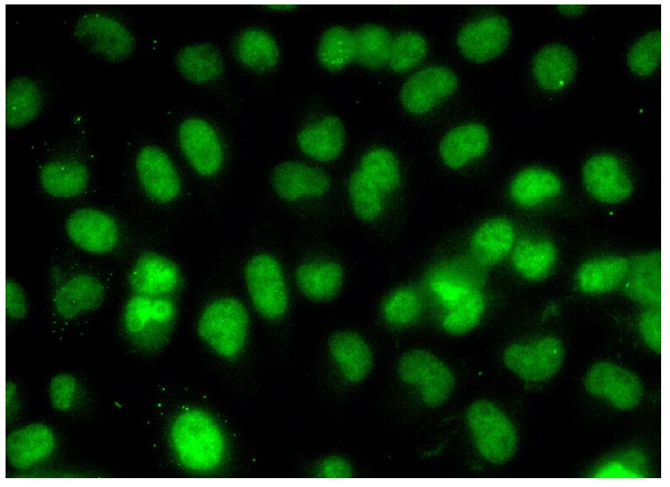 YY1 (C-20): sc-281. Immunofluorescence staining of formalin-fixed HeLa cells showing nuclear localization. Kindly provided by Yang Xiang, Ph.D., Division of Newborn Medicine, Boston Childrens Hospital, Cell Biology Department, Harvard Medical School.