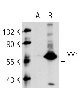 YY1 (C-20): sc-281. Western blot analysis of YY1 expression in non-transfected: sc-117752 (A) and mouse YY1 transfected: sc-124689 (B) 293T whole cell lysates.