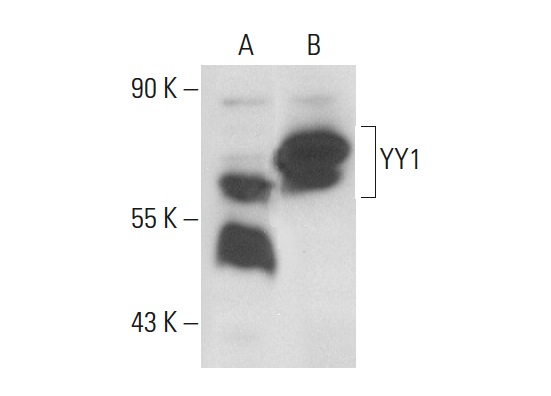 YY1 (C-20): sc-281. Western blot analysis of YY1 expression in non-transfected: sc-117752 (A) and human YY1 transfected: sc-172170 (B) 293T whole cell lysates.