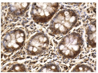 YY1 (C-20): sc-281. Immunoperoxidase staining of formalin fixed, paraffin-embedded human colon tissue showing nuclear and cytoplasmic staining of glandular cells.