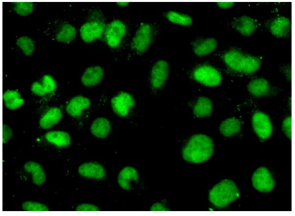 YY1 (H-414): sc-1703. Immunofluorescence staining of formalin-fixed HeLa cells showing nuclear localization. Kindly provided by Yang Xiang, Ph.D., Division of Newborn Medicine, Boston Childrens Hospital, Cell Biology Department, Harvard Medical School.
