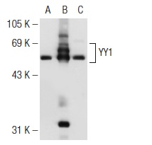 YY1 (H-414): sc-1703. Western blot analysis of YY1 expression in non-transfected 293T: sc-117752 (A), mouse YY1 transfected 293T: sc-124689 (B) and NIH/3T3 (C) whole cell lysates.