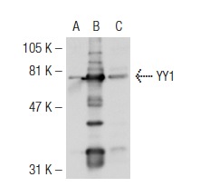 YY1 (H-414): sc-1703. Western blot analysis of YY1 expression in non-transfected 293T: sc-117752 (A), mouse YY1 transfected 293T: sc-124689 (B) and NIH/3T3 (C) whole cell lysates.