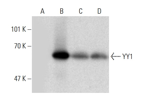 YY1 (H-414): sc-1703. Western blot analysis of YY1 expression in non-transfected: sc-117752 (A) and mouse YY1 transfected: sc-124689 (B) 293T whole cell lysates and Jurkat (C) and BJAB (D) nuclear extracts.