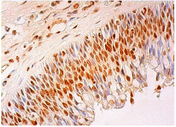ZNF161 (H-166): sc-98278. Immunoperoxidase staining of formalin fixed, paraffin-embedded human nasopharynx tissue showing nuclear staining of respiratory epithelial cells.