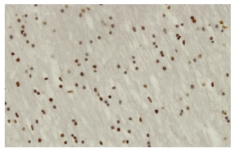 ZNF313 (SM-3): sc-101116. Immunoperoxidase staining of formalin-fixed, paraffin-embedded human lateral ventricle wall tissue showing nuclear localization.