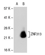ZNF313 (SM-3): sc-101116. Western blot analysis of ZNF313 expression in non-transfected: sc-117752 (A) and human ZNF313 transfected: sc-112985 (B) 293T whole cell lysates.
