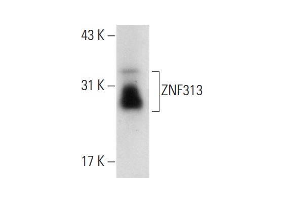 ZNF313 (SM-3): sc-101116. Western blot analysis of ZNF313 expression in Hep G2 whole cell lysate.
