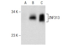 ZNF313 (SM-3): sc-101116. Western blot analysis of ZNF313 expression in non-transfected 293T: sc-117752 (A), mouse ZNF313 transfected 293T: sc-127822 (B) and A2058 (C) whole cell lysates.