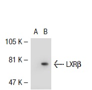LXRα/β (C-19): sc-1201. Western blot analysis of LXRβ expression in non-transfected: sc-117752 (A) and human LXRβ transfected: sc-112157 (B) 293T whole cell lysates.