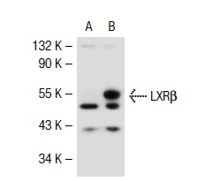 LXRβ (S-16): sc-34343. Western blot analysis of LXRβ expression in non-transfected: sc-117752 (A) and human LXRβ transfected: sc-117211 (B) 293T whole cell lysates.
