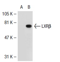 LXRβ (S-16): sc-34343. Western blot analysis of LXRβ expression in non-transfected: sc-117752 (A) and human LXRβ transfected: sc-112157 (B) 293T whole cell lysates.