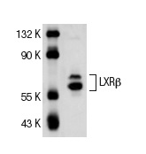 LXRβ (S-16): sc-34343. Western blot analysis of LXRβ expression in HeLa nuclear extract.