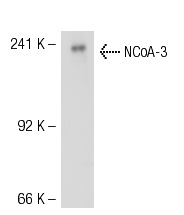 NCoA-3 (M-397): sc-9119. Western blot analysis of NCoA-3 expression in HeLa whole cell lysate.