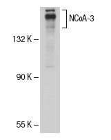 NCoA-3 (M-397): sc-9119. Western blot analysis of NCoA-3 expression in HeLa whole cell lysate.