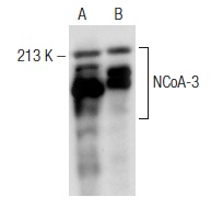 NCoA-3 (M-397): sc-9119. Western blot analysis of NCoA-3 expression in Jurkat (A) and K-562 (B) whole cell lysates.
