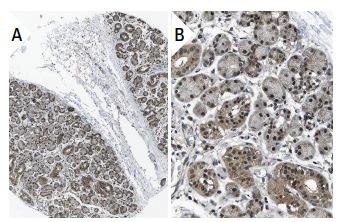 Nurr1/Nur77 (E-20): sc-990. Immunoperoxidase staining of formalin fixed, paraffin-embedded human salivary gland tissue showing nuclear and cytoplasmic staining of glandular cells (low and high magnification). Kindly provided by The Swedish Human Protein Atlas (HPA) program.