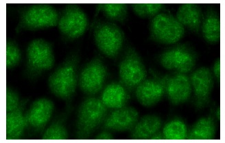 Nurr1/Nur77 (E-20): sc-990. Immunofluorescence staining of methanol-fixed HeLa cells showing nuclear localization.