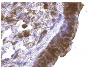 Nurr1/Nur77 (E-20): sc-990. Immunoperoxidase staining of formalin fixed, paraffin-embedded human bronchus tissue showing nuclear and cytoplasmic staining of respiratory epithelial cells.