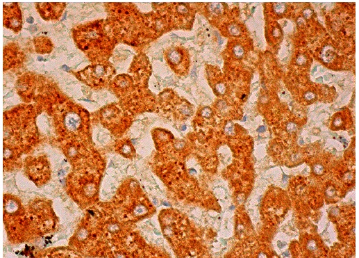 GP-39 (S-18): sc-30465. Immunoperoxidase staining of formalin fixed, paraffin-embedded human liver tissue showing cytoplasmic staining of hepatocytes.