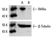 RARα siRNA (h): sc-29465. Western blot analysis of RARα expression in non-transfected control (A) and RARα siRNA transfected (B) HeLa cells. Blot probed with RARα (C-20): sc-551. β Tubulin (D-10): sc-5274 used as specificity and loading control.