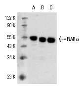 RARα (C-20): sc-551. Western blot analysis of RARα expression in SK-BR-3 (A) and MCF7 (B) nuclear extracts and AML-193 whole cell lysate (C).