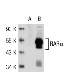 RARα (C-20): sc-551. Western blot analysis of RARα expression in non-transfected: sc-117752 (A) and human RARα transfected: sc-117323 (B) 293T whole cell lysates.