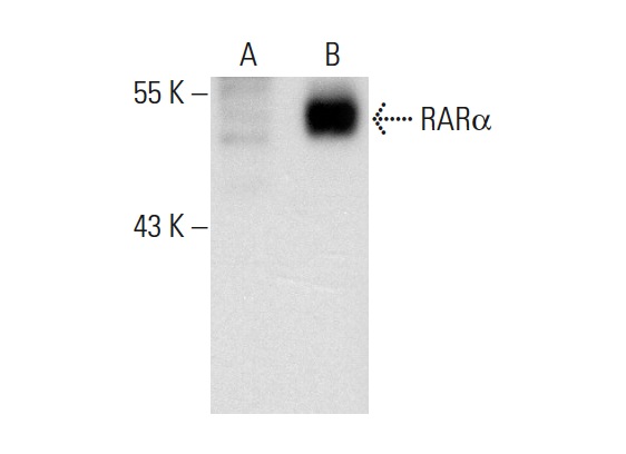 RARα (C-20): sc-551. Western blot analysis of RARα expression in non-transfected: sc-117752 (A) and mouse RARα transfected: sc-125890 (B) 293T whole cell lysates.