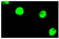 VDR (D-6): sc-13133. Immunofluorescence staining of methanol-fixed A-431 cells showing nuclear staining.