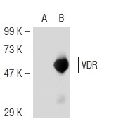 VDR (D-6): sc-13133. Western blot analysis of VDR expression in non-transfected: sc-117752 (A) and mouse VDR transfected: sc-124548 (B) 293T whole cell lysates.