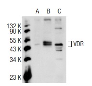 VDR (D-6): sc-13133. Western blot analysis of VDR expression in non-transfected 293T: sc-117752 (A), human VDR transfected 293T: sc-178119 (B) and HeLa (C) whole cell lysates.