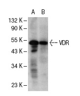 VDR (D-6): sc-13133. Western blot analysis of VDR expression in T-47D (A) and HL-60 (B) whole cell lysates.