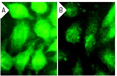 Akt2 siRNA (h): sc-29197. Immunofluorescence staining of methanol-fixed, control HeLa (A) and Akt2 siRNA silenced HeLa (B) cells showing diminished cytoplasmic and nuclear staining in the siRNA silenced cells. Cells probed with Akt2 (D-17): sc-7127.