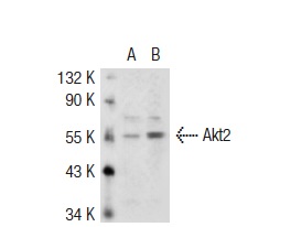 Akt2 (D-17): sc-7127. Western blot analysis of Akt2 expression in non-transfected: sc-117752 (A) and mouse Akt2 transfected: sc-126407 (B) 293T whole cell lysates.