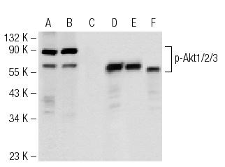 Western blot analysis of Akt1/2/3 phosphorylation in untreated (A, D), calyculin treated (B, E) and calyculin and lambda protein phosphatase treated (C, F) Jurkat whole cell lysates. Antibodies tested include p-Akt1/2/3 (Ser 473)-R: sc-7985-R (A, B, C) and Akt1 (C-20): sc-1618 (D, E, F).