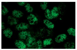 p-Akt1/2/3 (Ser 473)-R: sc-7985-R. Immunofluorescence staining of methanol-fixed A-431 cells showing nuclear localization.