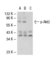 p-Akt1/2/3 (Ser 473)-R: sc-7985-R. Western blot analysis of Akt2 phosphorylation in non-transfected: sc-117752 (A), untreated human Akt2 transfected: sc-116831 (B) and lambda protein phosphatase treated human Akt2 transfected: sc-116831 (C) 293T whole cell lysates.