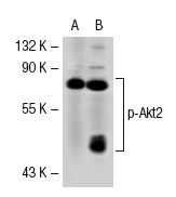 p-Akt1/2/3 (Ser 473)-R: sc-7985-R. Western blot analysis of Akt2 phosphorylation in non-transfected: sc-117752 (A) and human Akt2 transfected: sc-116831 (B) 293T whole cell lysates.