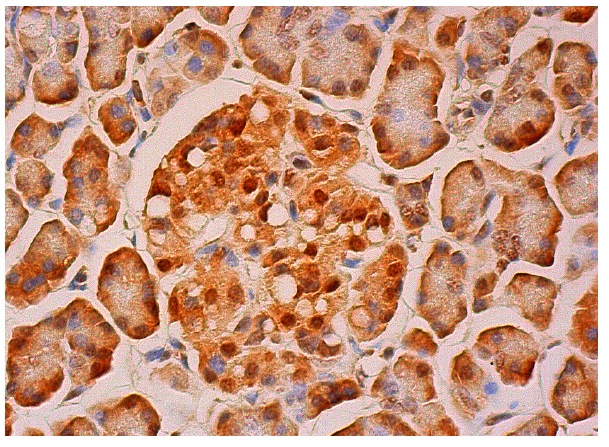 p-Akt1/2/3 (Ser 473)-R: sc-7985-R. Immunoperoxidase staining of formalin fixed, paraffin-embedded human pancreas tissue showing nuclear and cytoplasmic staining of exocrine glandular cells and Islets of Langerhans.