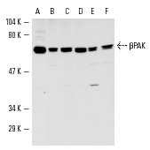 βPAK (N-19): sc-1871. Western blot analysis of βPAK expression in rat brain extract (A) and HeLa (B), Jurkat (C), SK-N-MC (D), T24 (E) and U-937 (F) whole cell lysates.