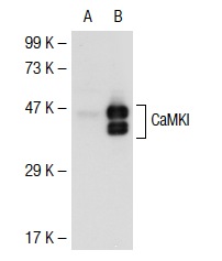 CaMKI (H-125): sc-33165. Western blot analysis of CaMKI expression in non-transfected: sc-117752 (A) and mouse CaMKI transfected: sc-118979 (B) 293T whole cell lysates.