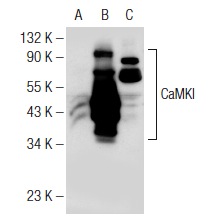 CaMKI (H-125): sc-33165. Western blot analysis of CaMKI expression in non-transfected: sc-117752 (A) and human CaMKI transfected: sc-177014 (B) 293T whole cell lysates and mouse brain tissue extract (C).